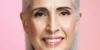 نقش کلاژن در بدن